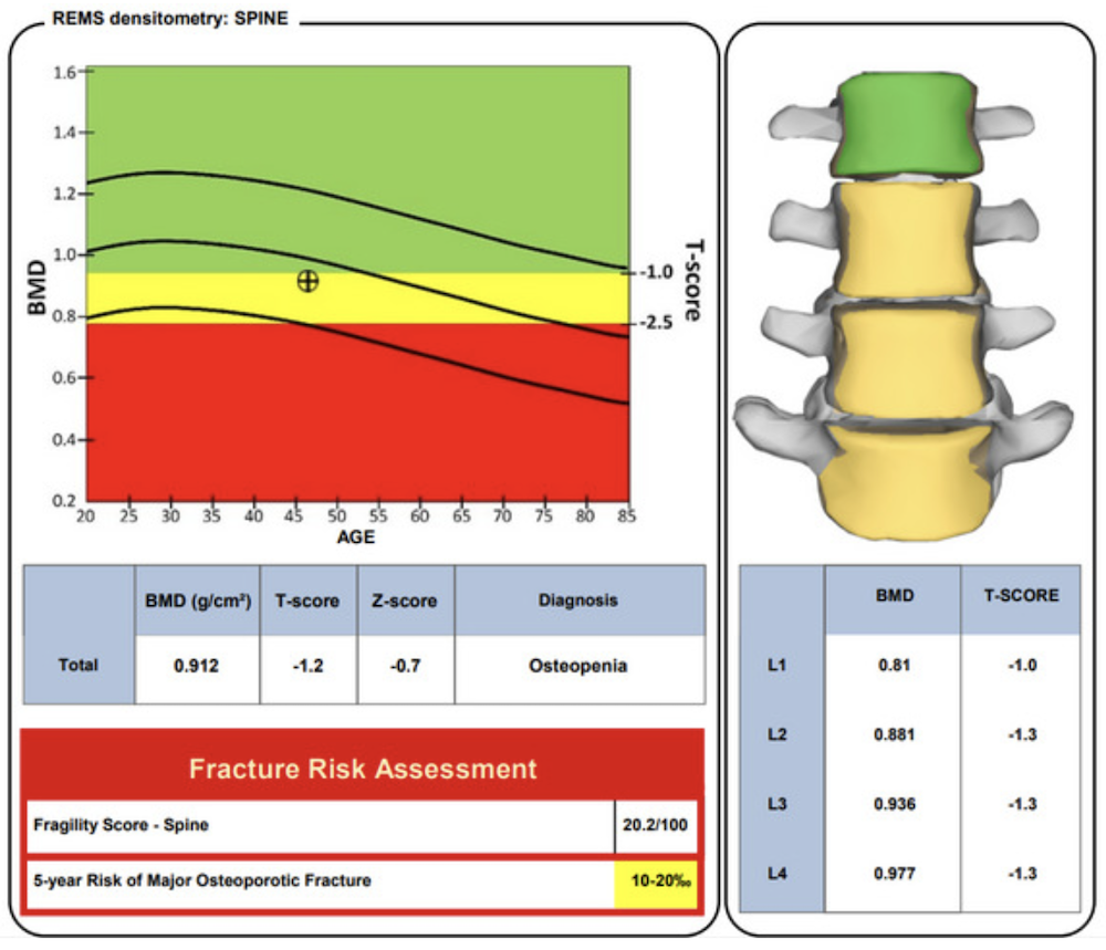 Sample REMS report — example 1