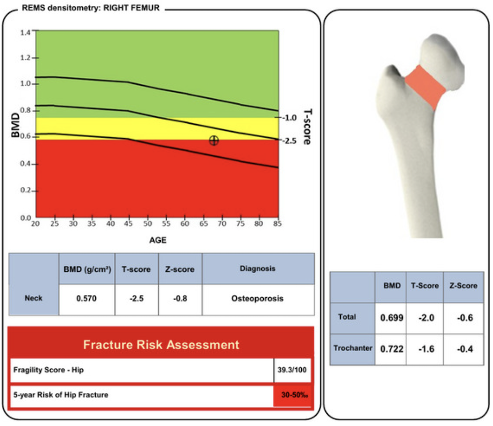 Sample REMS report — example 2